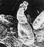 Intestinal Parasite